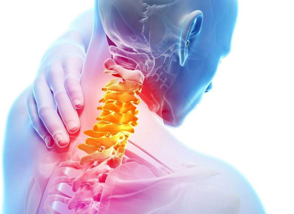 bolečine v vratni hrbtenici z osteohondrozo