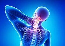 osteohondroza - bolezen hrbtenice