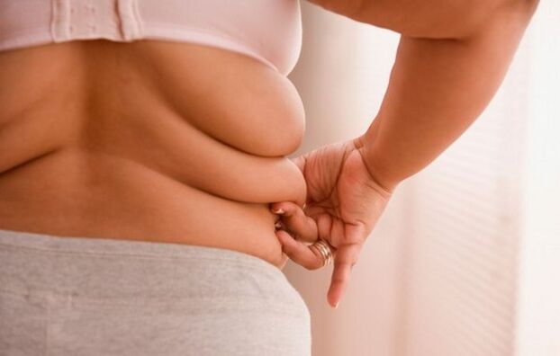 prekomerna telesna teža, vzrok cervikalne osteohondroze pri ženskah, mlajših od 40 let