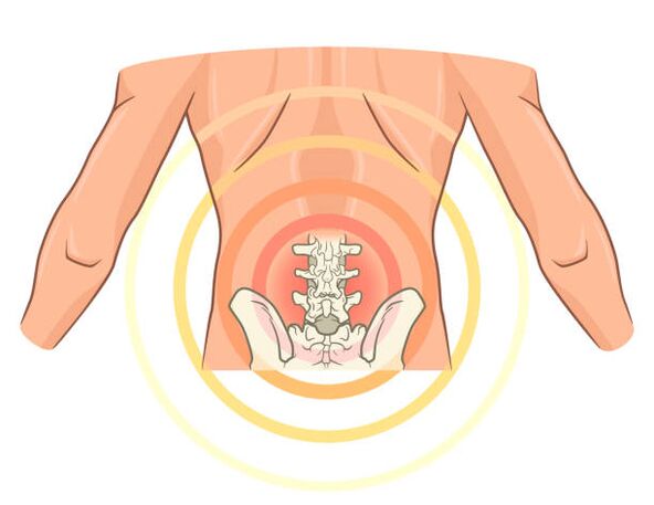 osteohondroza ledvene hrbtenice